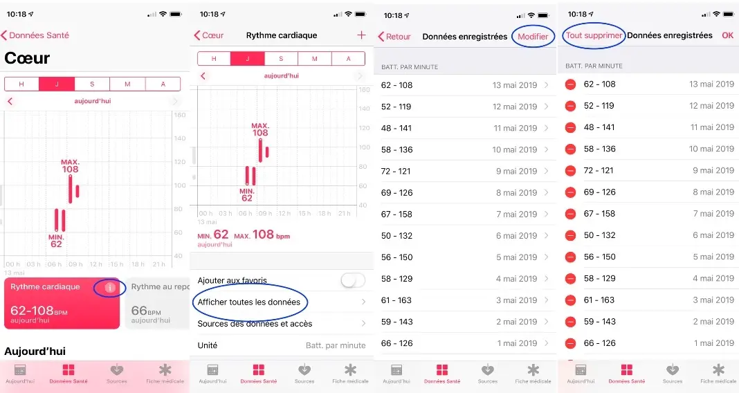 Astuce : supprimer les données de suivi de l'App Santé sur iOS