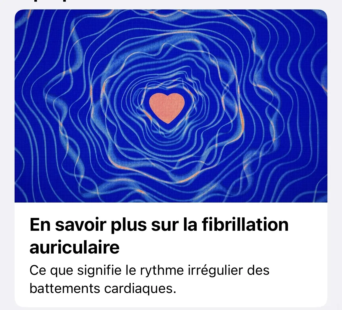 iOS16 / watchOS 9 commencent à proposer l’Historique de fibrillation auriculaire