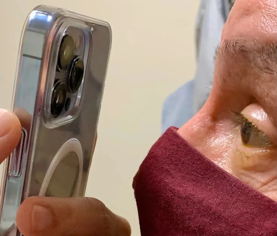 Un ophtalmologue utilise le mode Macro de l’iPhone 13 Pro Max pour suivre ses patients