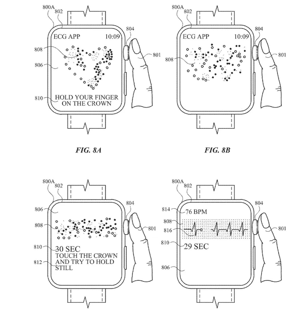 Apple dépose le brevet nécessaire à son étude sur l'Apple Watch et la prévention des AVC