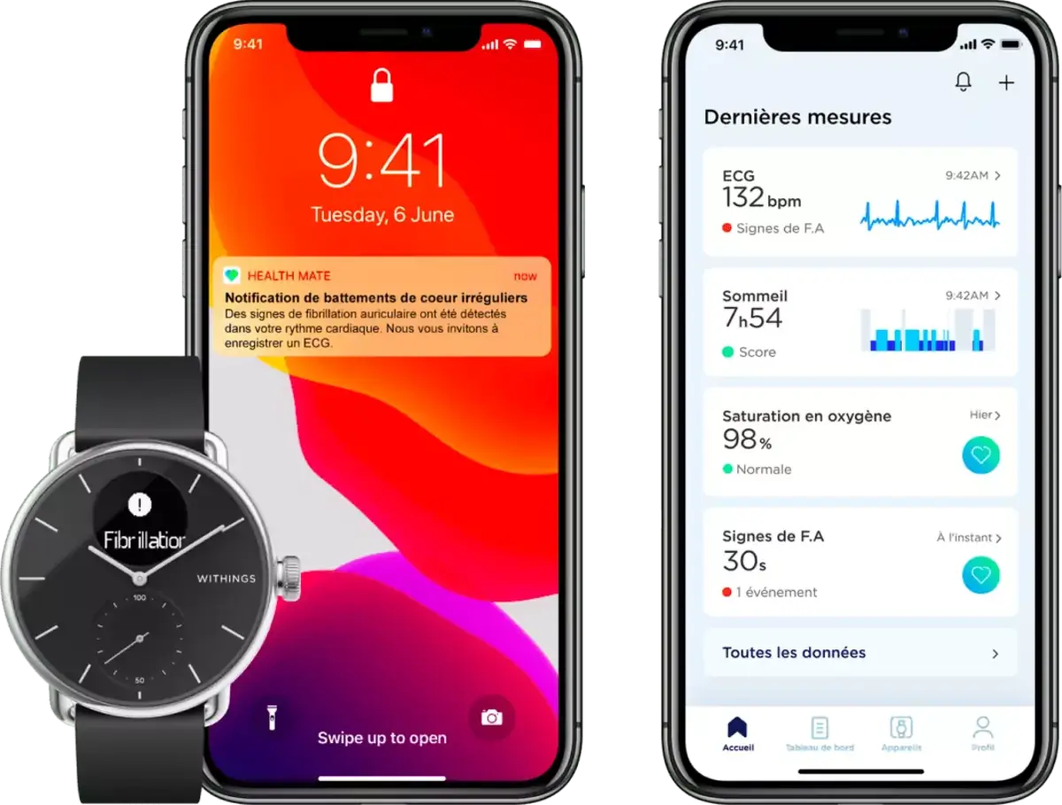 La ScanWatch de Withings détecte l'apnée du sommeil (+ ECG, saturation