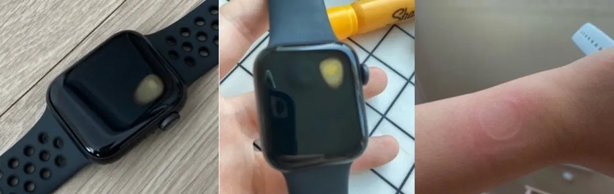 Plusieurs cas de surchauffe pour des Apple Watch SE en Corée du Sud