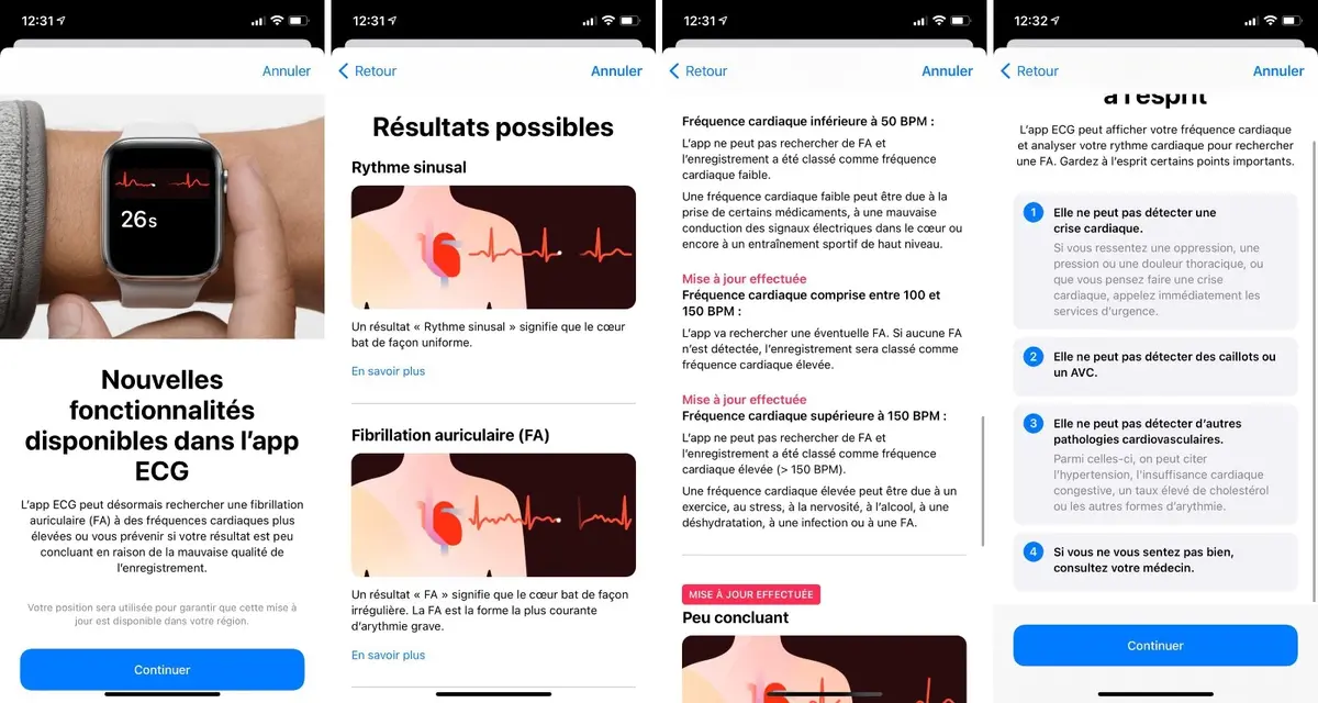 iOS 14.3 et watchOS 7.2 : les nouveautés sur la Santé cardiovasculaire (notifications...)