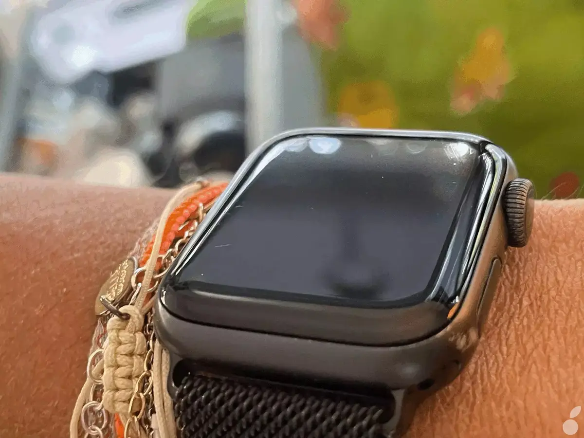 Avez-vous constaté une usure particulière de votre Apple Watch ? [sondage]