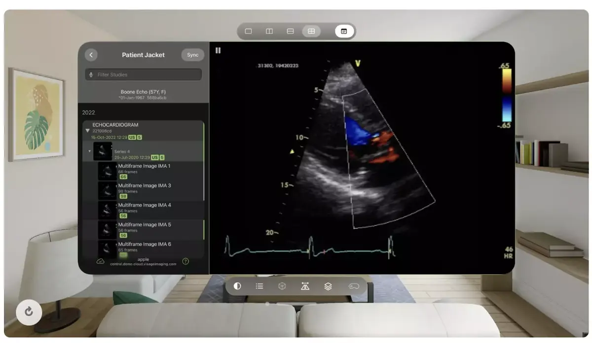 Le Vision Pro, un nouvel assistant médical (avec une IA) ?