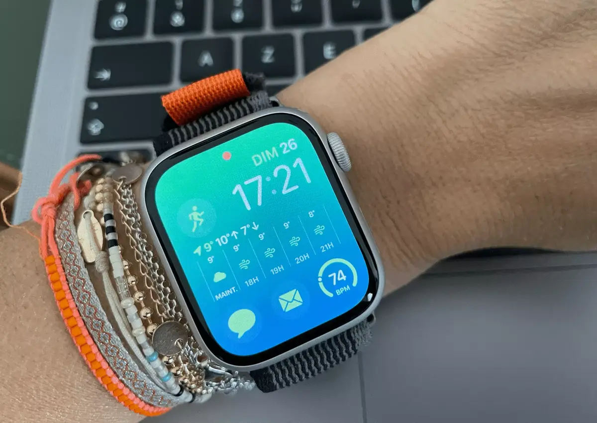 Apple Watch Glucose