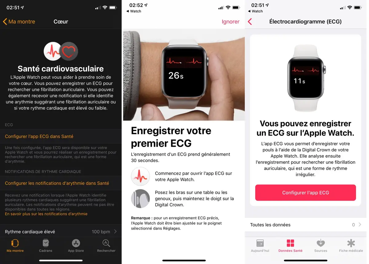 L'ECG configurable en France sur certaines Apple Watch avec la beta de WatchOS 5.2