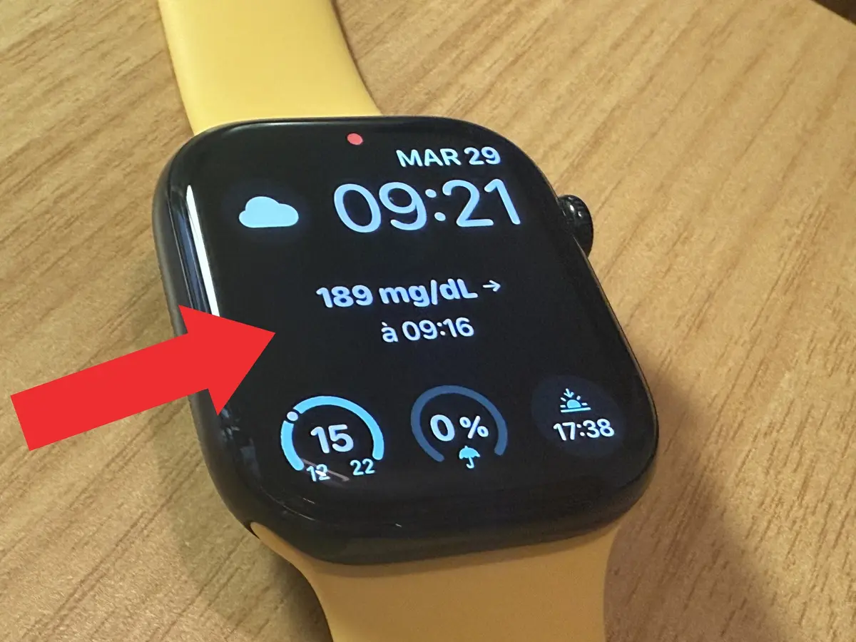 Comment afficher sa glycémie sur Apple Watch avec un Freestyle Libre ? L'astuce ultime !