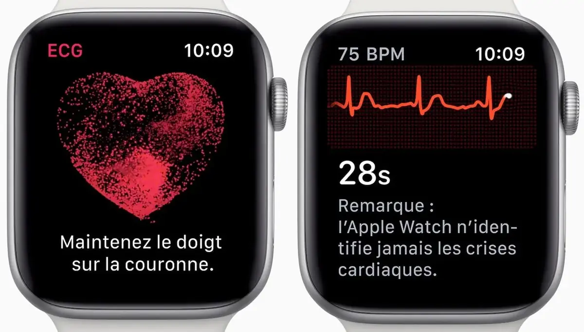 Que faut-il absolument faire pour &eacute;conomiser la batterie de votre Apple Watch&nbsp;?