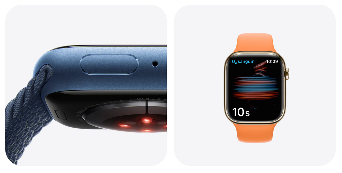 L'Apple Watch vous rend-elle anxieux ? (sondage)