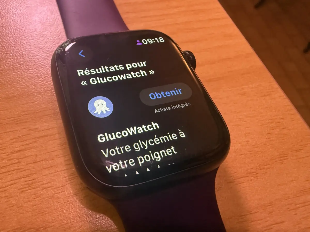 GlucoWatch en cours d'installation