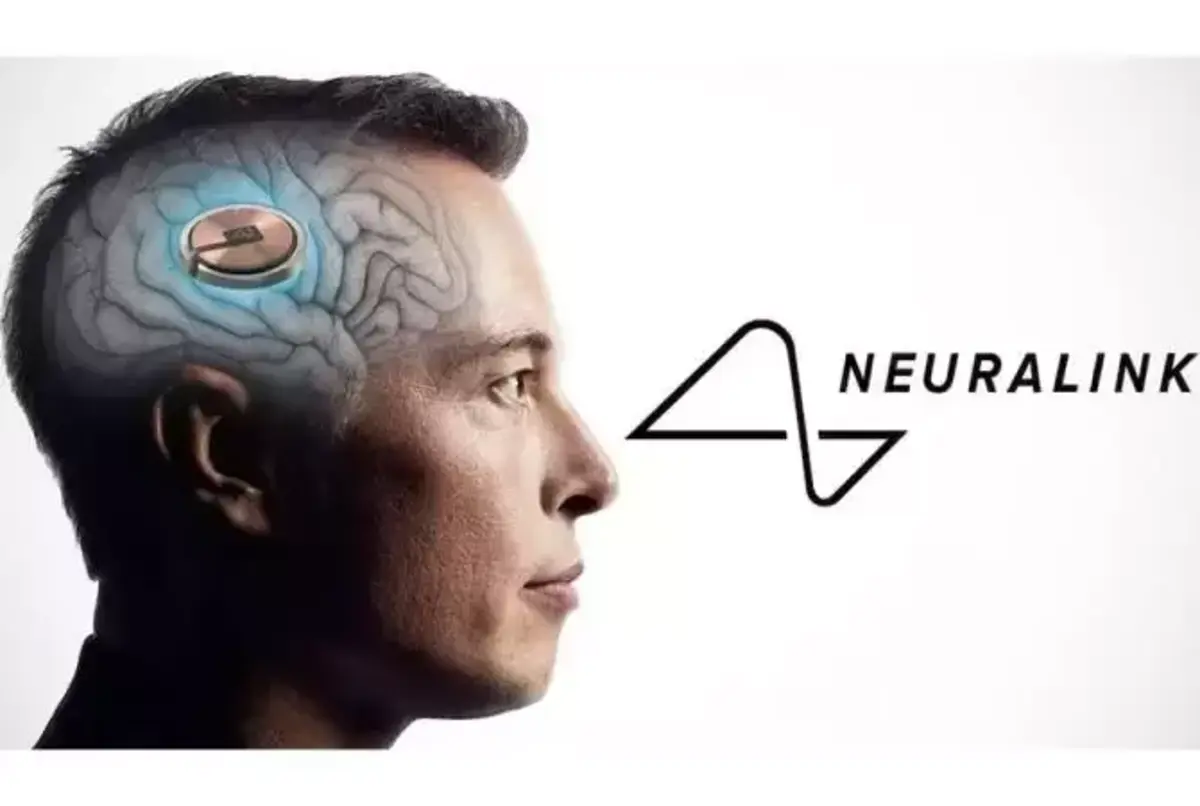 שבב Neuralink הראשון של אילון מאסק הושתל במוח אנושי
