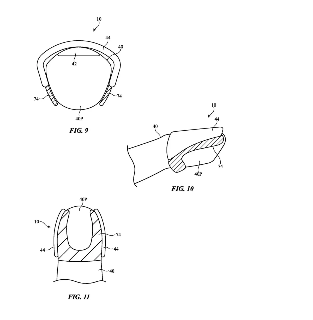 Et si le casque ARVR d'Apple était contrôlé grâce à une bague ?