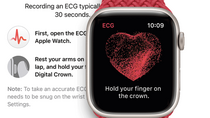 L'Apple Watch présente des données ECG plus lisibles et de meilleure qualité !