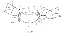 Apple travaille toujours sur une bague pour commander son Mac ou... son casque ARVR