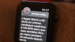 L'image du jour : l'Apple Watch vous alerte déjà en cas de problème cardiaque