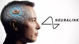 La 1ère puce Neuralink d'Elon Musk a été implantée dans un cerveau humain