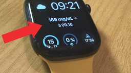 Comment afficher sa glycémie sur Apple Watch avec un Freestyle Libre ? L'astuce ultime !