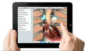 Les aimants de l'iPad dangereux pour les implantés cardiaques ?