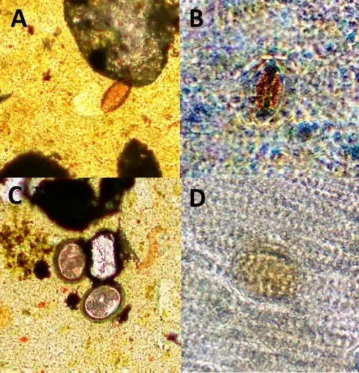 L'iPhone comme Microscope pour détecter les infections parasitaires en brousse