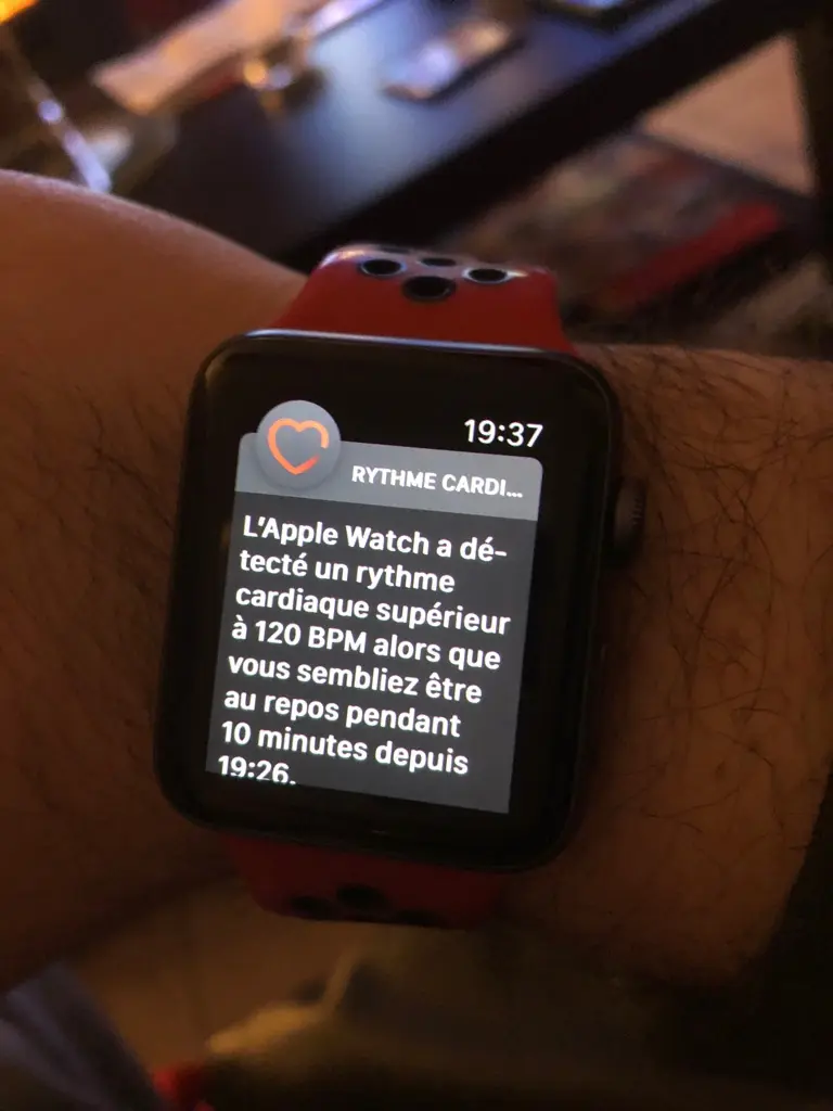 L'image du jour : l'Apple Watch vous alerte déjà en cas de problème cardiaque