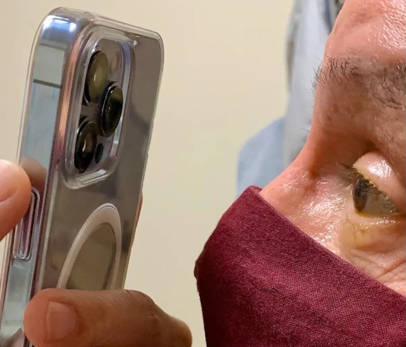 Illustration : Un ophtalmologue utilise le mode Macro de l’iPhone 13 Pro Max pour suivre ses patients