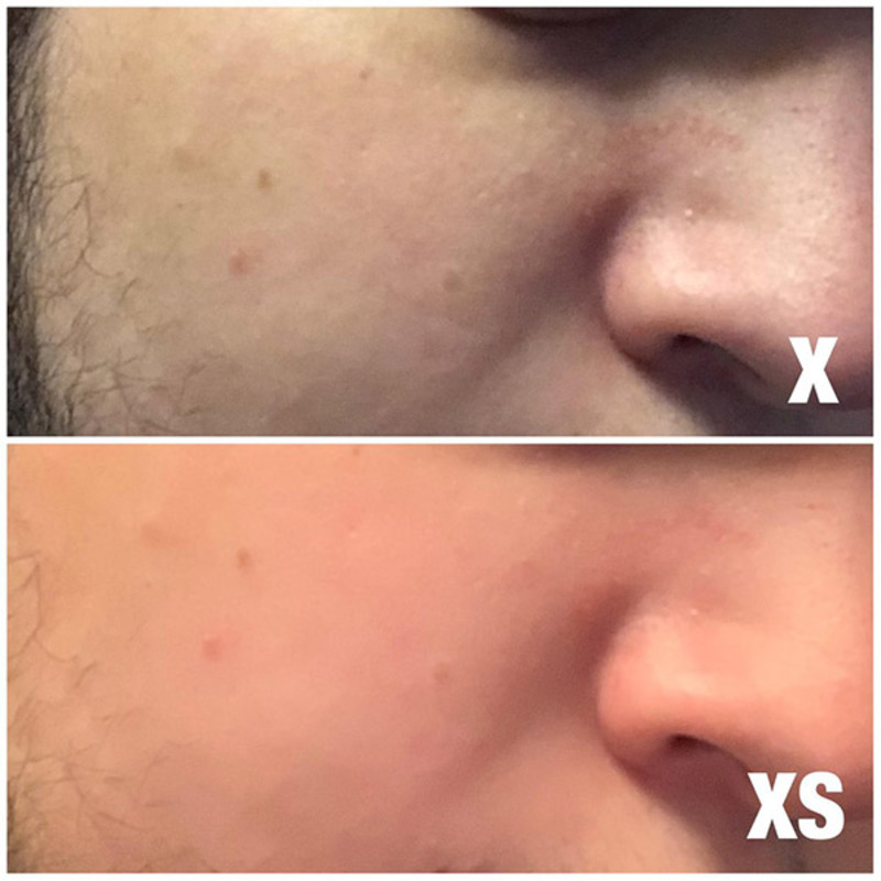 Illustration : Les iPhone XS (Max) appliqueraient automatiquement un "filtre beauté" sur les selfies