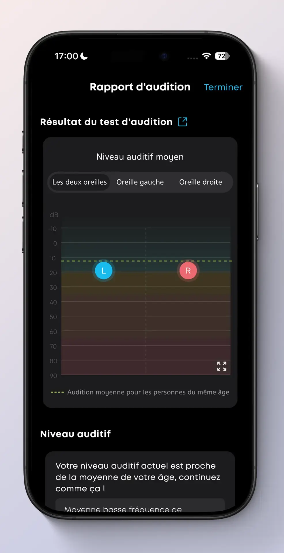 L'application propose de faire un test auditif et g&eacute;n&egrave;re un profil audio correspondant.